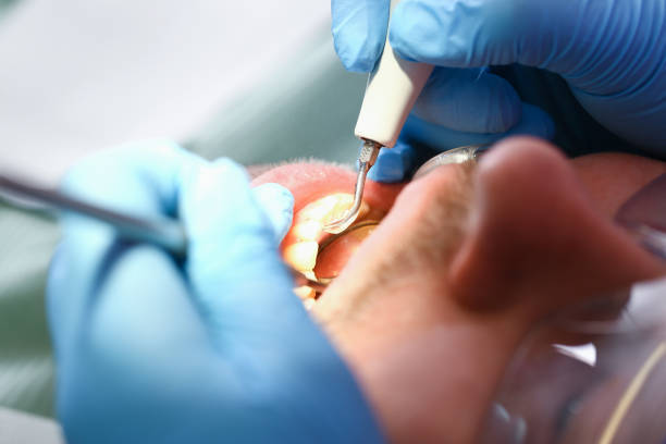 Best Urgent Tooth Repair  in Dermott, AR