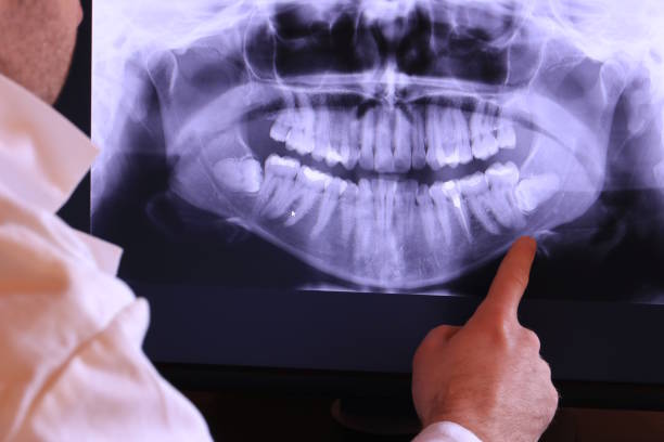 Best Emergency Gum Pain Relief  in Dermott, AR